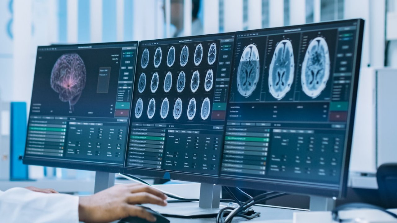 Computer monitor displaying advanced SSTR-targeting theranostic imaging scans for a neuroendocrine tumour patient.
