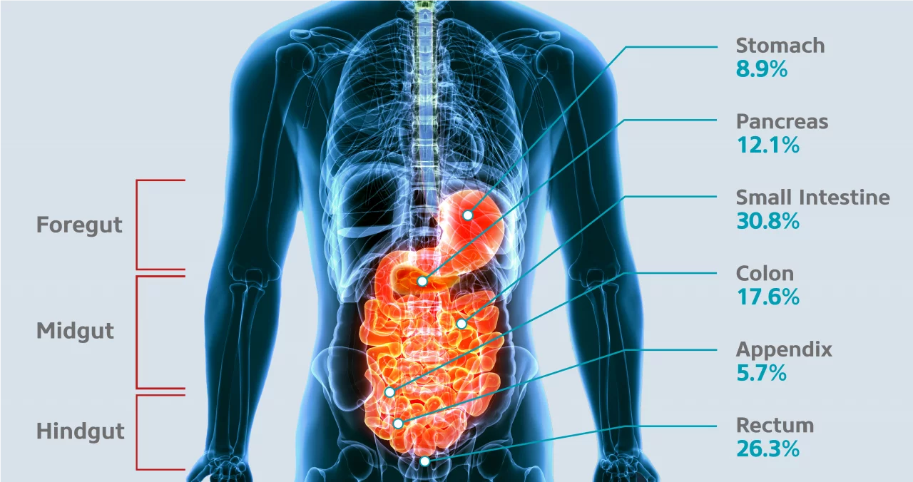Radiopharmaceuticals for rare GEP-NET tumors in specific organs.